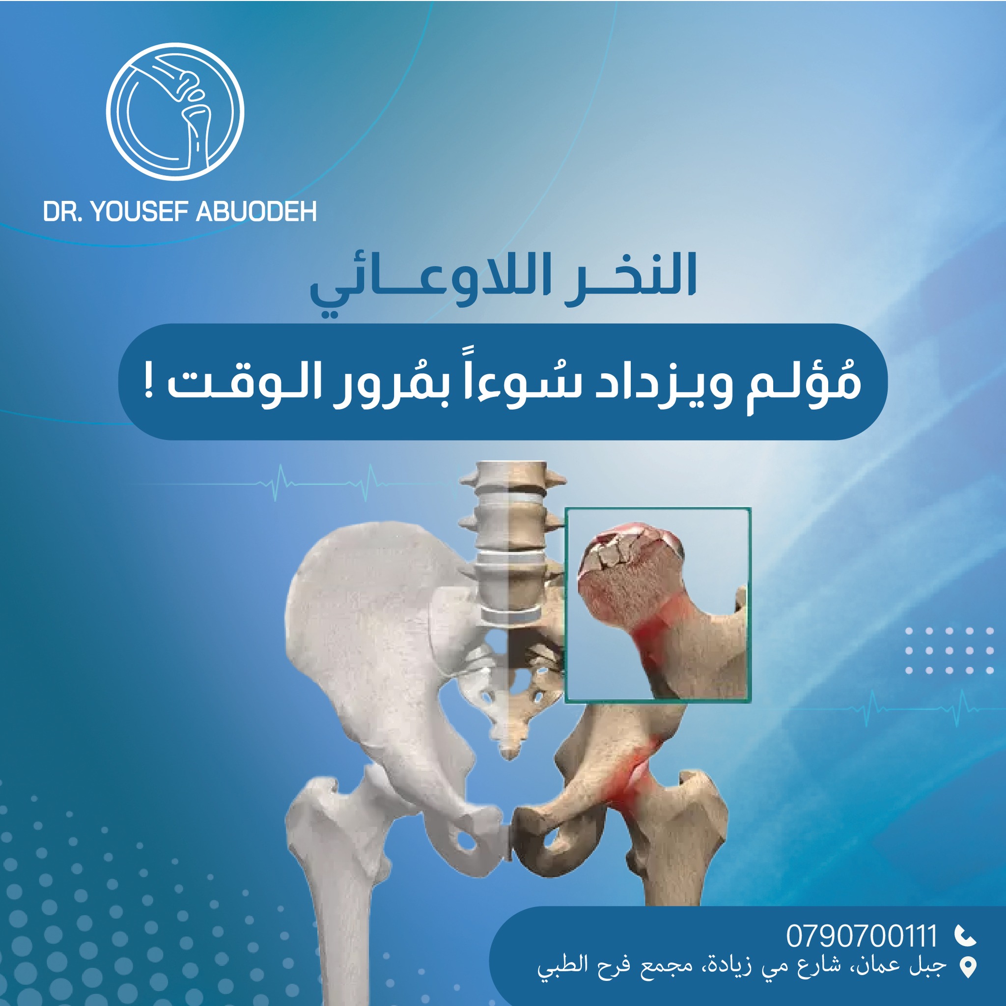 نخرمفصل الورك اللاوعائي Avascular Necrosis